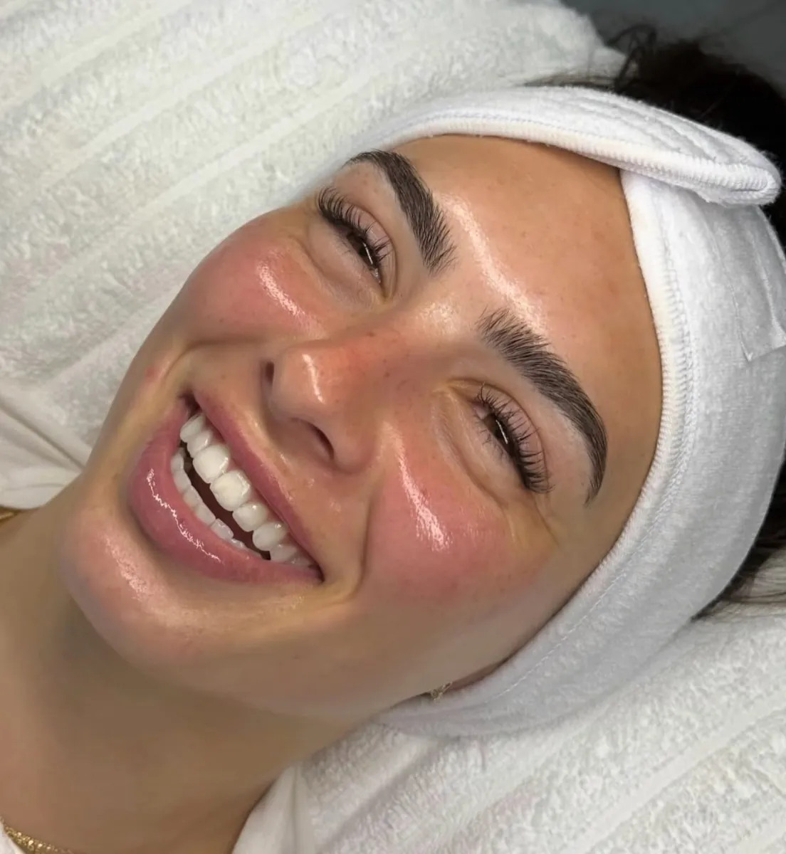 Paciente sonriendo después de su limpieza facial profunda en Esbelta, Juliaca