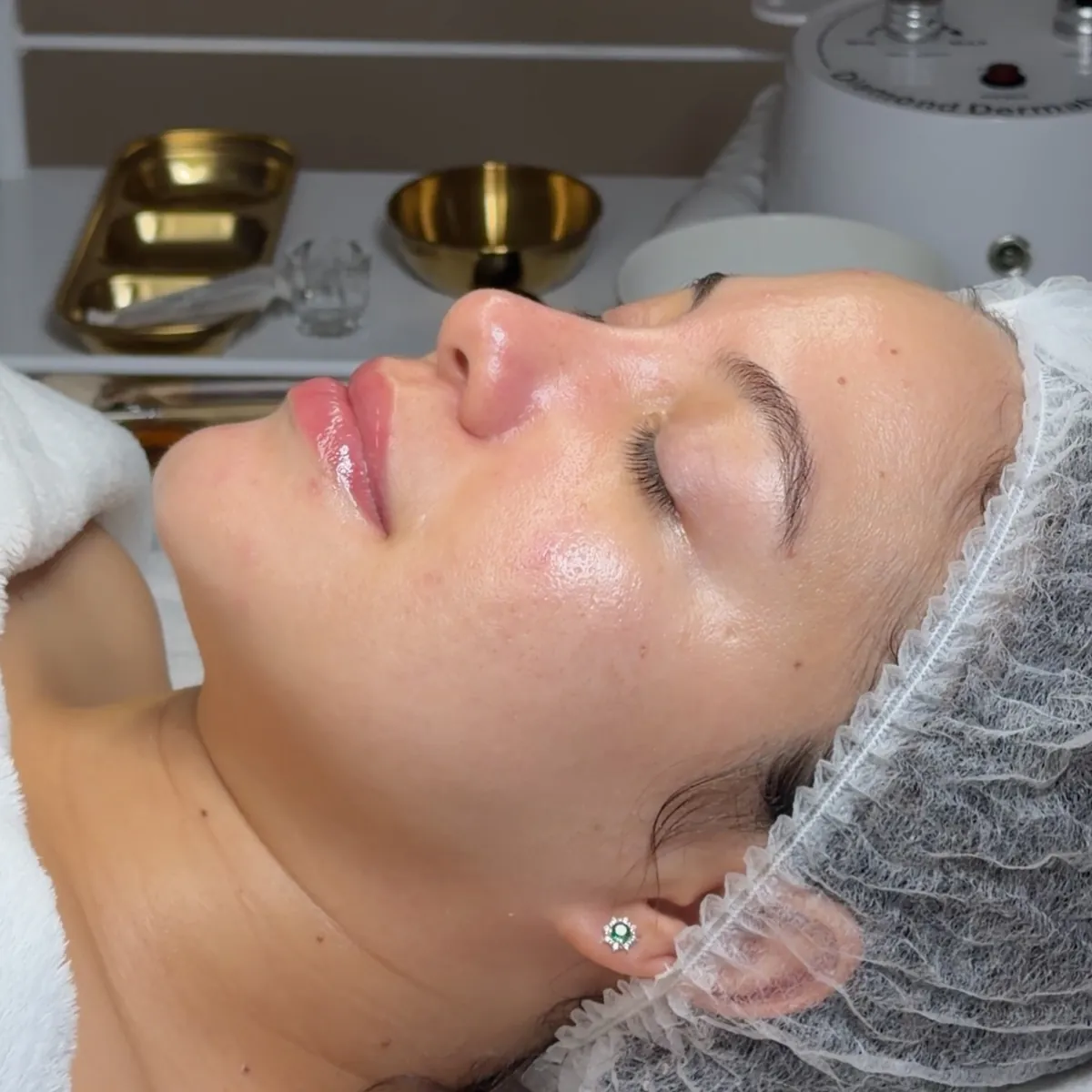 Paciente durante una limpieza facial profunda en Esbelta, Juliaca, con equipo de dermoabrasión